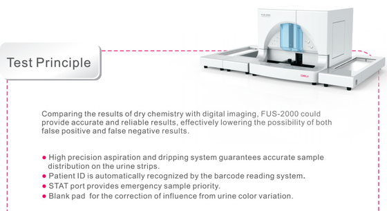 Automatische Harnuntersuchungs-Kreuzung des ODM-Urin-Sediment-Analysator-FUS-2000